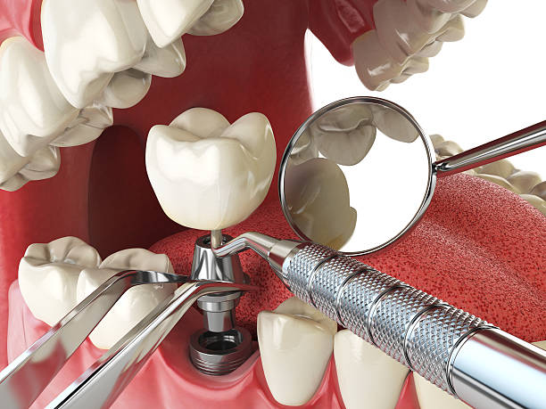 Best Walk-In Emergency Dentist in Geneva, WA