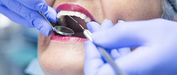 Best Emergency Wisdom Teeth Removal in Geneva, WA